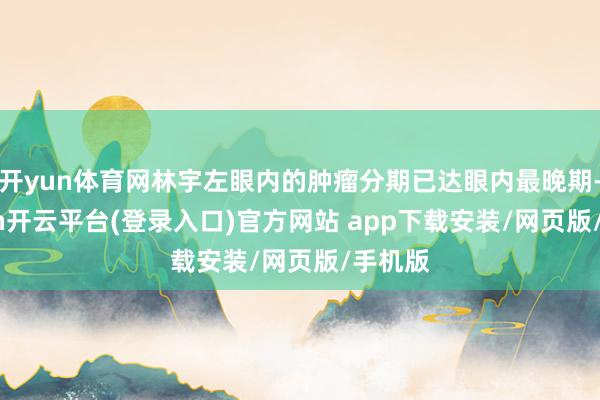 开yun体育网林宇左眼内的肿瘤分期已达眼内最晚期-kaiyun开云平台(登录入口)官方网站 app下载安装/网页版/手机版